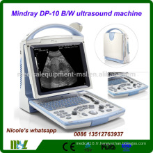 DP-10 Dernière machine à ultrasons portable Mindray CE FDA / machine à ultrasons portable avec sonde convexe et sonde transvaginale